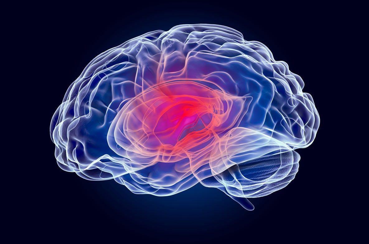 Visual of brain with disease